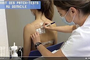 Patch-tests en dermato-allergologie